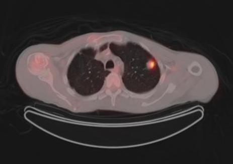 Lesion Characterization 47 year old man with multiple trauma