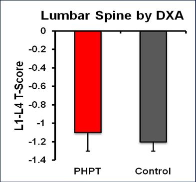 The Conundrum in Primary Hyperparathyroidism Lumbar spine BMD in PHPT is