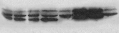 A 74 ΡΕ ΡΕ Χρόνος (λεπτά) 0 1 2 5 0 1 2 5 p-erk1/2 πυρήνας κυτταρόπλασμα B ΡΕ ΡΕ Χρόνος (λεπτά) 0 5 10 15 0 5 10 15 p-p38 MAPK p38 MAPK πυρήνας κυτταρόπλασμα Γ Ιστόνη 1 πυρήνας κυτταρόπλασμα Εικ. 1.7. Υποκυτταρική κατανομή των ERK1/2 και p38 MAPK σε καρδιακά μυοκύτταρα ενήλικου αρουραίου.