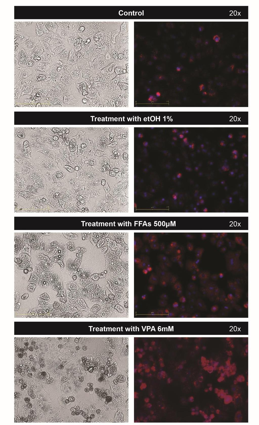 3.2. High Content Screening των σταγονιδίων λιπιδίων Το ενδοκυτταρικό φορτίο λιπιδίων προσδιορίστηκε με χρήση της φθορίζουσας χρωστικής Nile Red. Μικροσκοπικές εικόνες (Εικόνες 3.2, 3.