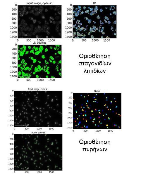 Εικόνα 3.3 Ενδείξεις ενδοκυτταρικής συγκέντρωση λιπιδίων από μικροσκοπία φθορισμού (οπτικός φακός 20x) 3.3. Image analysis Η ποσοτικοποίηση των ενδοκυτταρικών σταγονιδίων λιπιδίων έγινε υπολογιστικά, με χρήση του ελεύθερου λογισμικού CellProfiler.