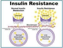 Lifestyle and Aging Effects in the Development of Insulin Resistance Activating