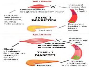 αποτέλεσμα την ολική έλλειψη ή την ελάχιστη έκκριση ινσουλίνης και έτσι παρατηρούνται υψηλά επίπεδα γλυκόζης στο αίμα και στα ούρα (υπεργλυκαιμία και γλυκοζουρία αντίστοιχα).