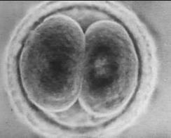 Διάφορες απόψεις (Γνώμη ΕΕΒΚ 2007) Βιοηθικά Διλήμματα Το γονιμοποιημένο ωάριο/έμβρυο ΕΙΝΑΙ ισοδύναμο με το ανθρώπινο ον Από την σύλληψη του το ζυγωτό αρχίζει να ζει και να εξελίσσεται ψυχοσωματικά σε