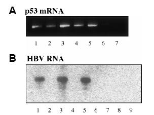 Aνοσοκαταστολή Χημειοθεραπεία σε HBsAg-/anti-HBc+ ασθενείς (πιθανή κρυπτική HBV λοίμωξη) HBV DNA σε ήπαρ: 59% (52/88) HBsAg(-) ασθενών με χρόνια ηπατική νόσο (Brechot et al.