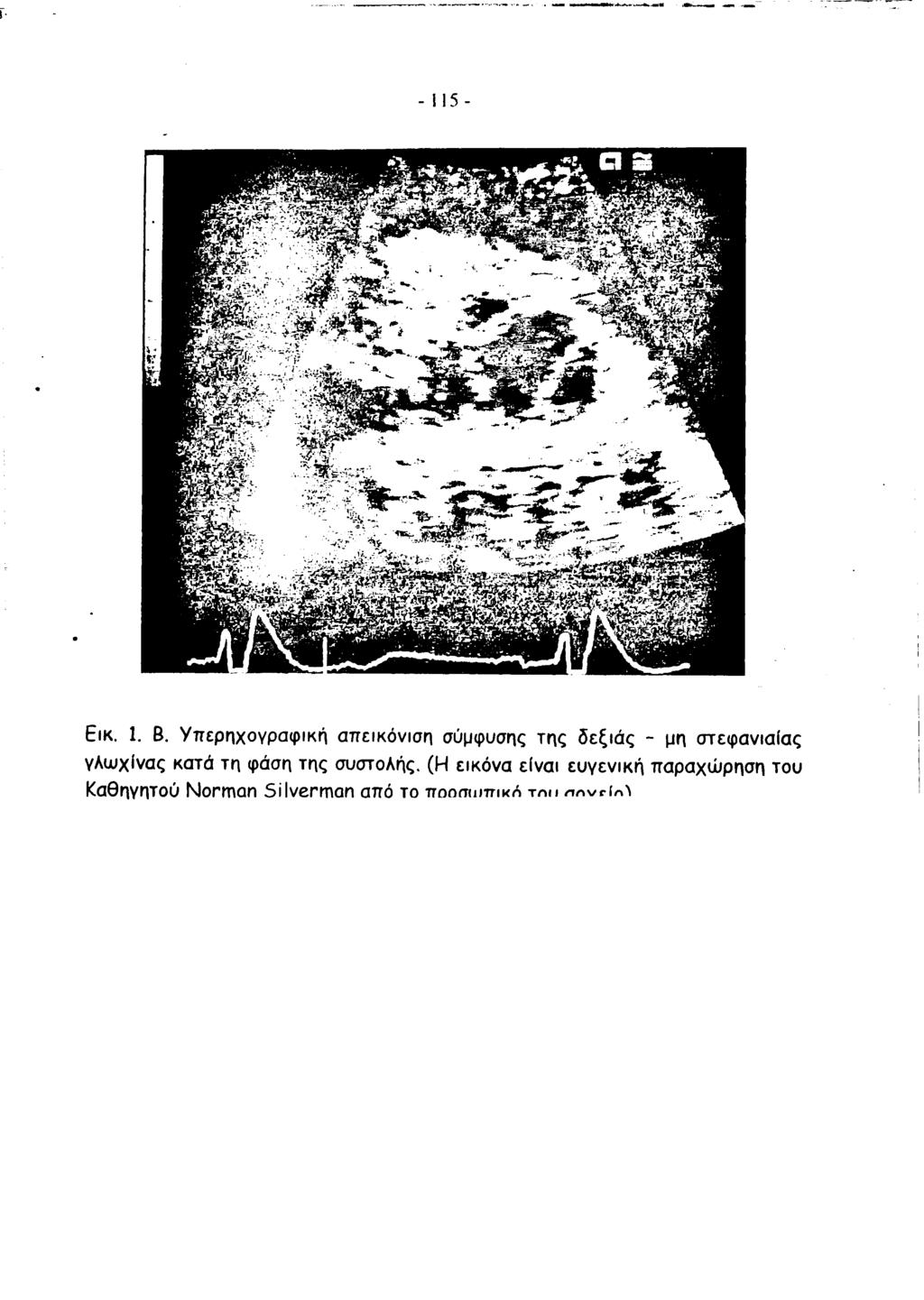 1 1 5 - Εικ. 1. Β.