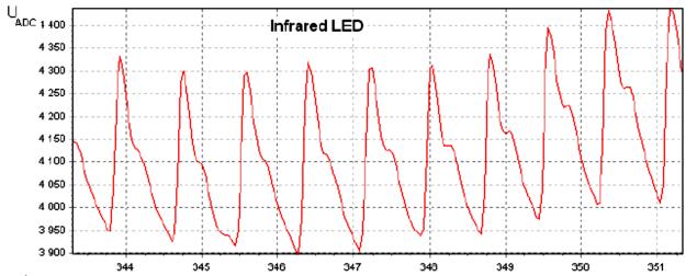 Short Answer Questions (50 pts) Ερωτήσεις με σύντομες απαντήσεις (50 μ.). Pulse Oximetry (5 pt.) Παλμική Οξυμετρία (5 μ.) (a.) In a pulse oximeter, we use only the time varying portion of the light.