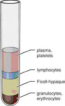Εικόνα 3. Διαχωρισμός συστατικών αίματος με χρήση Ficoll. Μετά τη φυγοκέντρηση, τα κύτταρα διαχωρίζονται με βάση την πυκνότητά τους και σχηματίζουν στρώματα.