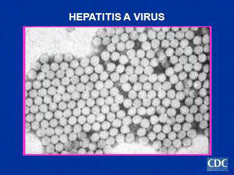 Εικόνα 1: Ο ιός της ηπατίτιδας Α στο ηλεκτρονικό μικροσκόπιο πηγή: Centers for Disease Control and Prevention (CDC), Atlanta, USA 86 http://www.cdc.gov/ncidod/diseases/hepatitis/slideset/hep06.
