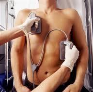 CV causes of sudden death in young athletes HCM Coronary artery anomalies Commontio cordis (i.