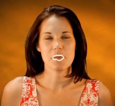 Στις περιπτώσεις όπου επηρεάζει το άνω χείλος, αυτό μπορεί να οφείλεται στην προεξοχή του άνω χείλους.