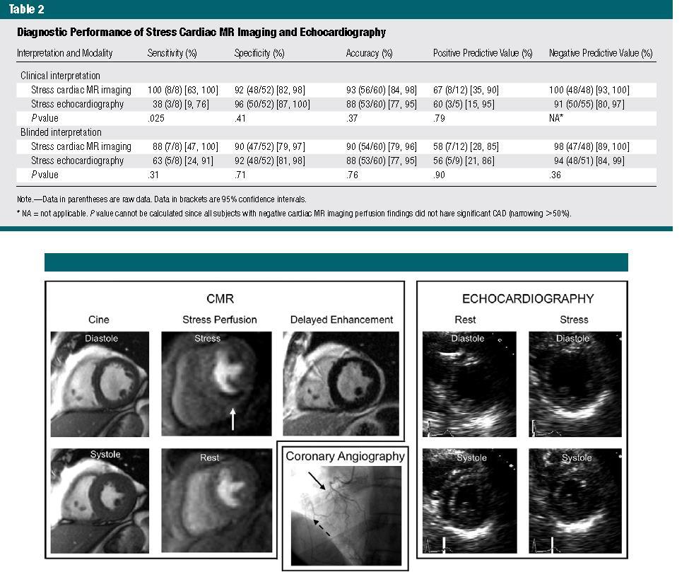 Stress Cardiac MR Imaging Compared with Stress Echocardiography in the Early Evaluation of Patients Who Present to the