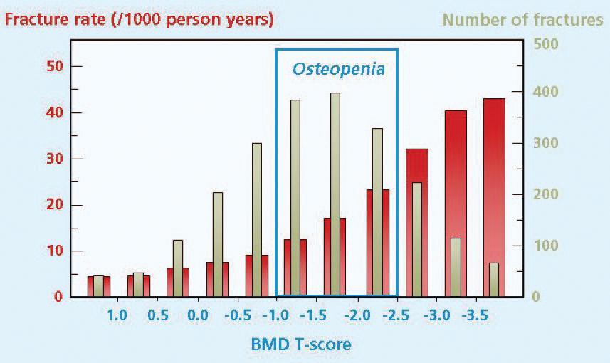 www BMD is a strong predictor of fracture risk.