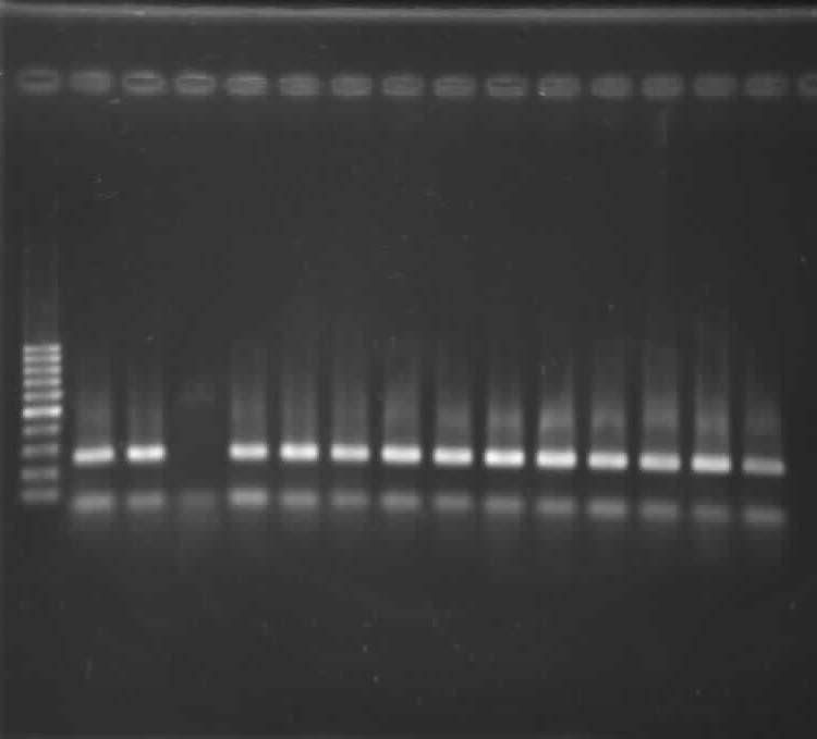 آلويوكوكوس اوتيتيديس و التهاب گوش مياني جدول شماره 1: سيكل دمايي واكنش PCR براي شناسايي ژن 16SrRNA باكتري آلويوكوكوس Time (s) Temperature(c ) 300 94 First Denaturation 45 94 Denaturation 45 59