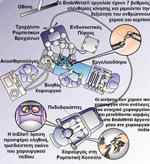 Αυτό το ςύςτημα ϋχει εξυπηρετόςει πολύ τουσ χειρούργουσ καθώσ