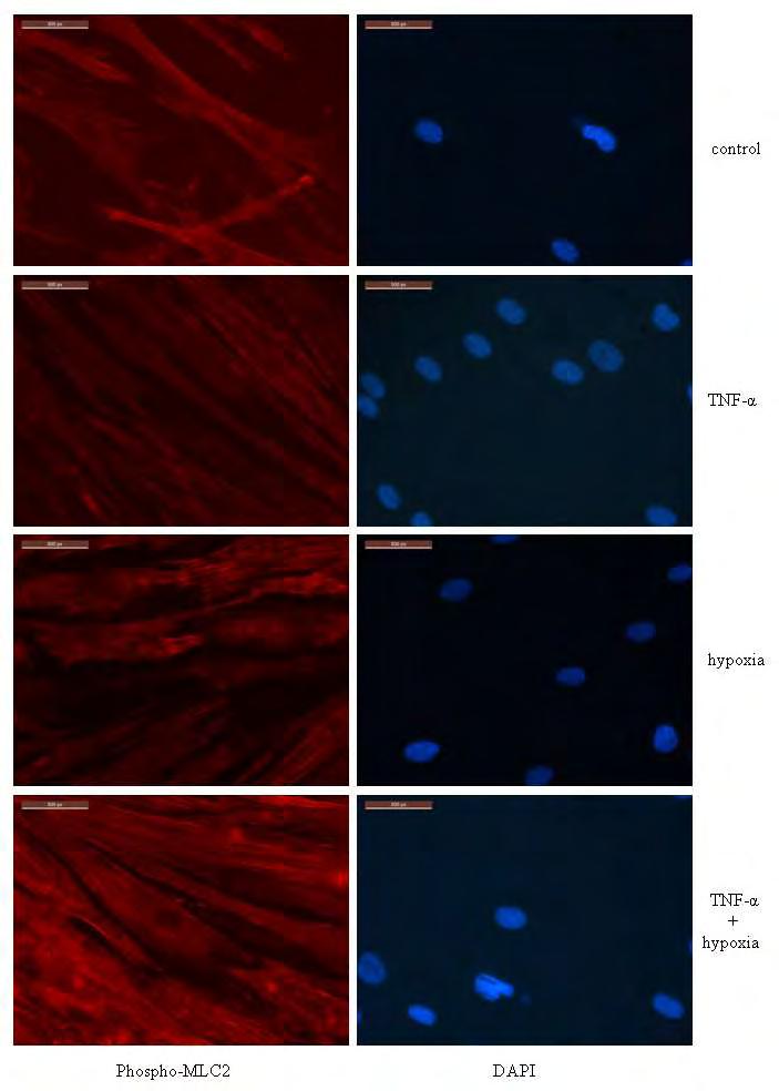 4.2.1.2. Ανίχνευση της Phospo-MLC2 Για να καθορίσουμε τη δραστικότητα της ΜLCK θελήσαμε να προσδιορίσουμε τα επίπεδα του υποστρώματός της phospho-mlc2.
