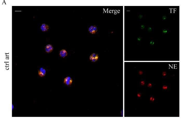 Intracellular TF