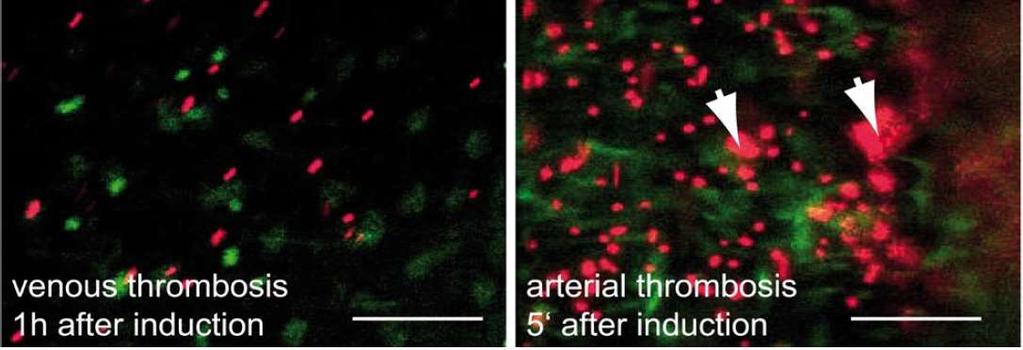 NETs in arterial