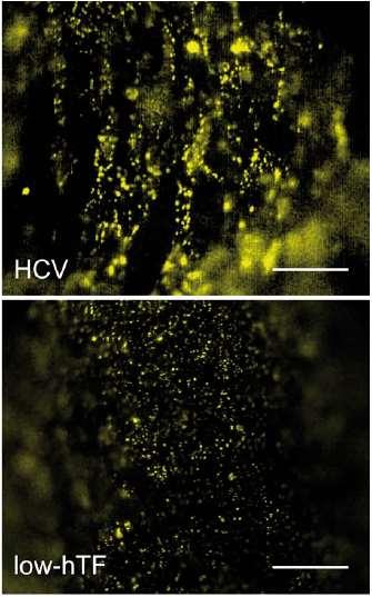 How innate immune cells initiate DVT development?