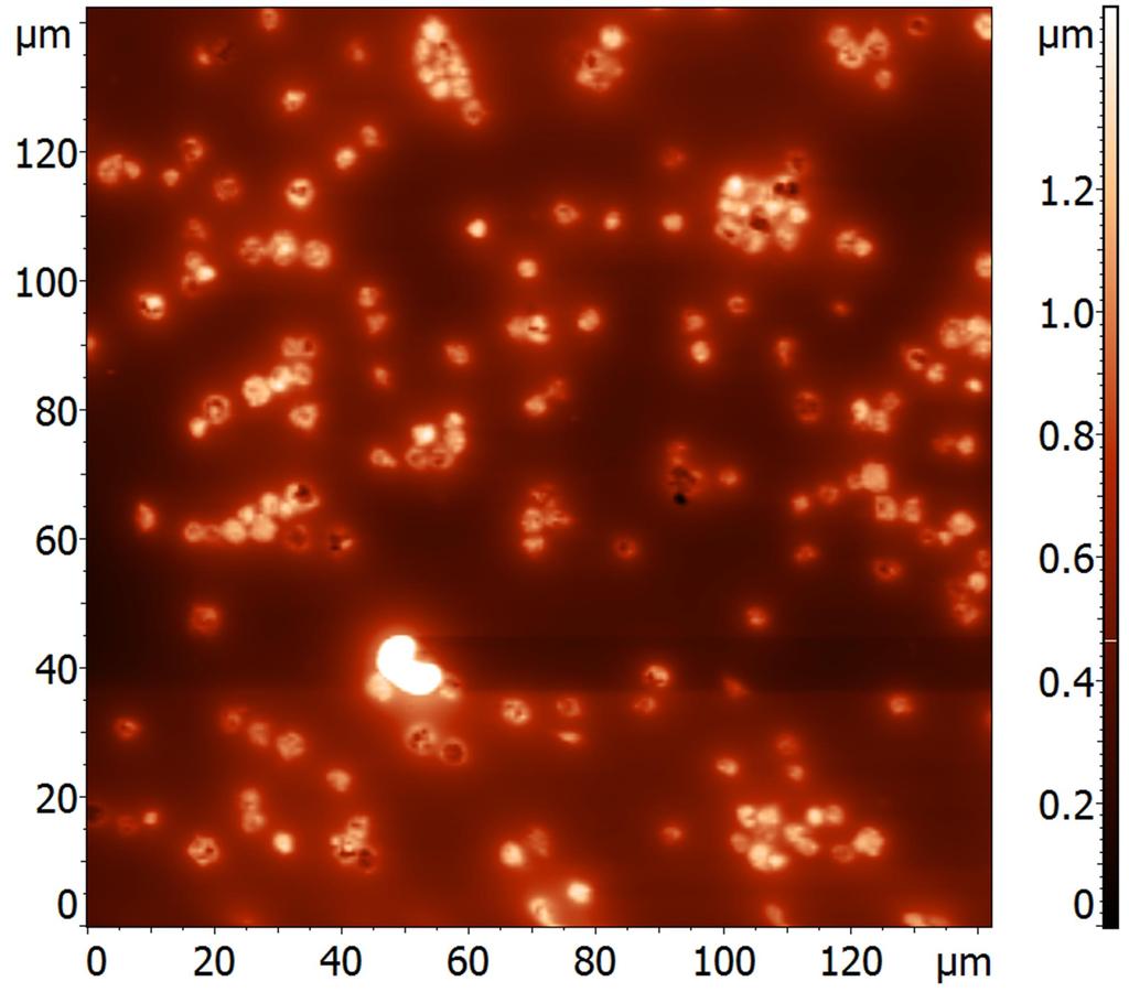Εικόνα 4.3.β: PCP_1Β: Αριστερά: Εικόνα τοπογραφίας ΜΑΔ σε κλίμακα 140x140μm, όπου φαίνονται πολλά αιμοπετάλια με τάση προς σχηματισμό συσσωματωμάτων και ένα παραμορφωμένο ερυθροκύτταρο.