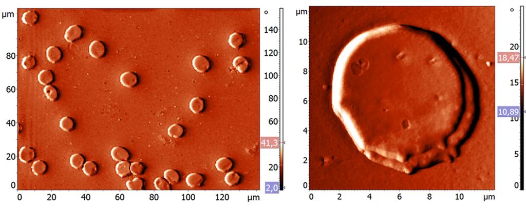 SR2_2H (150 μl αεκ και 15 μl αιθανόλης με παράγωγα καπνού): Παρατηρούμε ερυθροκύτταρα διαμέτρων 8-10 μm, που έχουν και εδώ την τάση να συγκολλούνται μεταξύ τους.