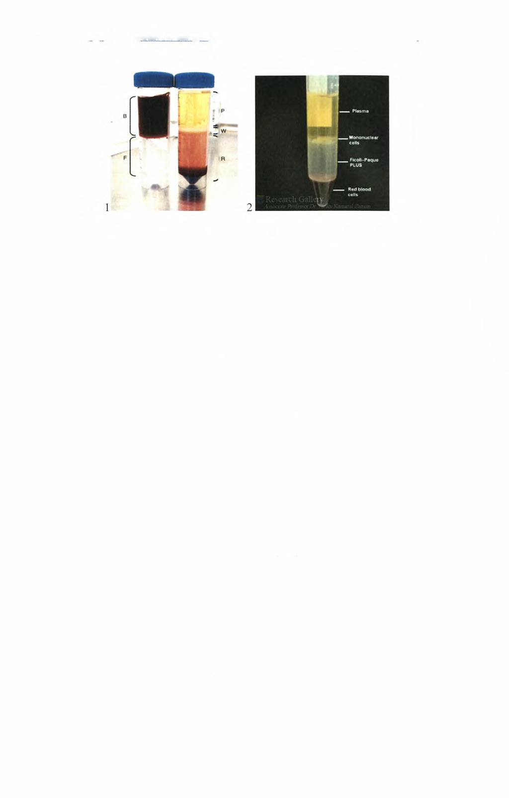 Ηπίόραση εκ7ΐ)λισυάτο)ν το>ν ψυγανθών στο σύστημα tpc γλουταθειόνηί ανθρώπινων ιιονοκύτταρων περιφερικού aiuaroc Εικόνα 2.1: 1) (Β) Το ευδιάκριτο στρώμα του αίματος και (F) το στρώμα με το Ficoll.