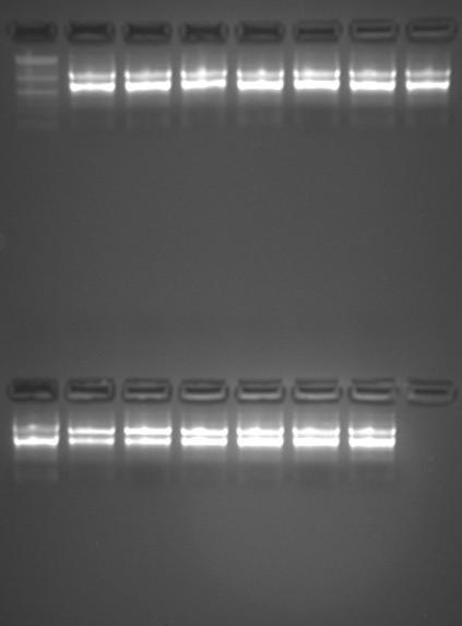 RNASE OUT 0,5 μl( συνολικά 4,5μl) H 2 O 4 μl ( συνολικά 36 μl) Ο έλεγχος της ύπαρξης υπολειμμάτων DNA στα δείγματα RNA ακόμη και μετά την αντίδραση Dnάσης, πραγματοποιήθηκε με αντίδραση PCR.