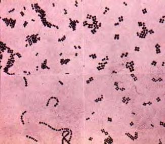 3mm σε πλάτος, και τα περιθώρια είναι δυσδιάκριτα.