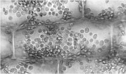 Pav. 1C-2 B) Ar ciklozės kryptis visose ląstelėse vienoda? C)Kokia gali būti praktinė ciklozės reikšmė augalų ląstelėse? 7. Dabar pakeiskite skystį aplink bandinį į koncentruotos druskos tirpalą (žr.