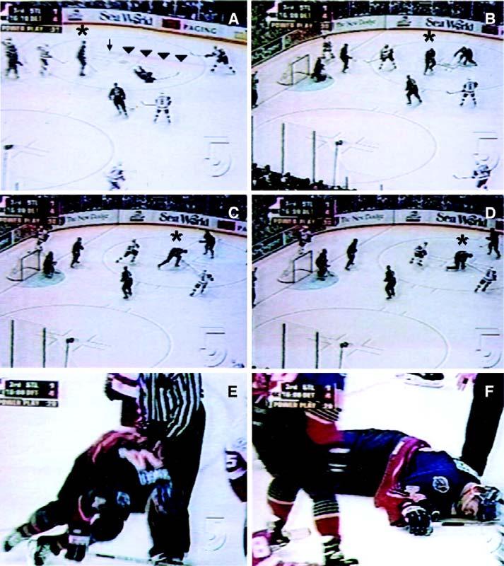 Stop-frame images of an aborted commotio cordis event during a televised professional hockey