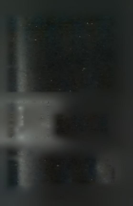 βλαβών του DNA και είναι 200 φορές πιο ευαίσθητος δείκτης των βλαβών του DNA από ότι είναι η μελέτη των χρωμοσωμικών ατυπιών (Latt S.A., 1974).