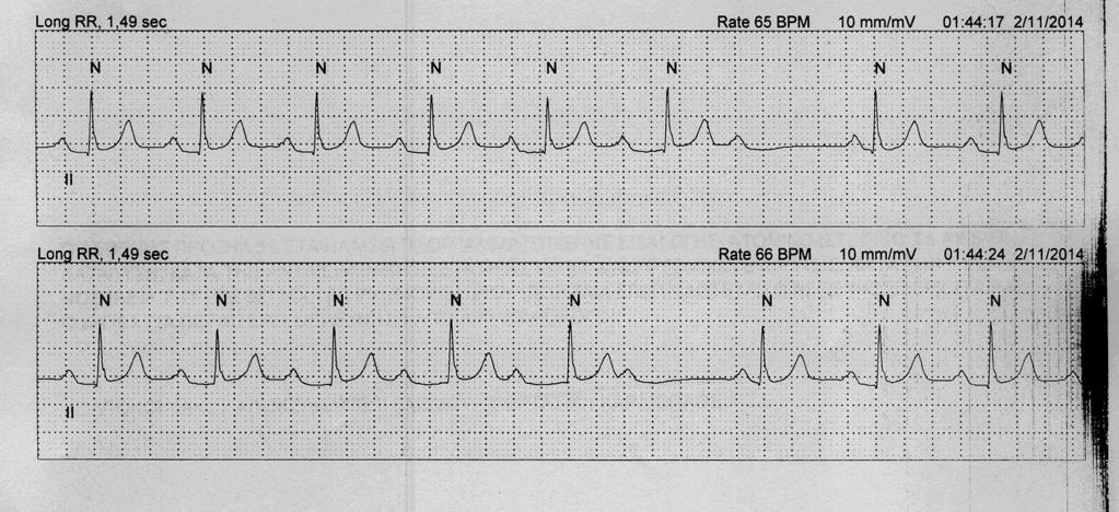 HOLTER 6 months