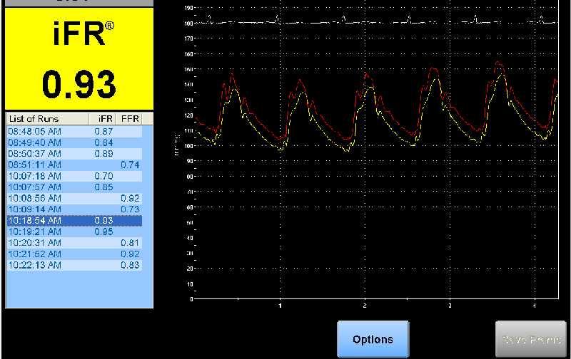 ifr AFTER