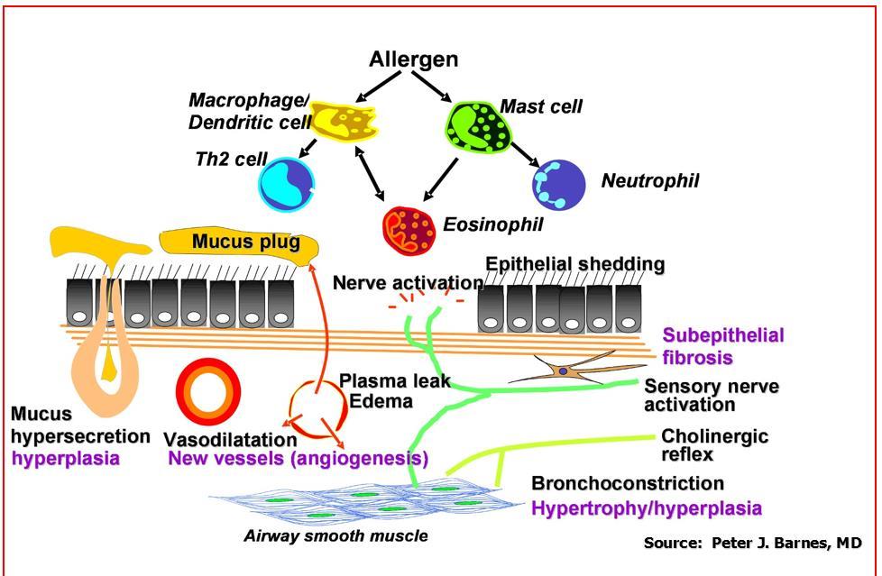 Rolul inflamatiei si al bronhoconstrictiei in astm: - inflamatia mucus in exces, fb musculare se contracta calibru redus al cailor respiratorii - bronhoconstrictie alveole umplute cu aer si musculara