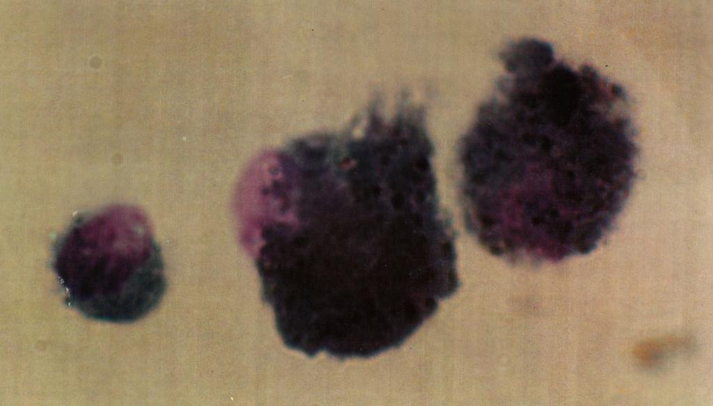 Alveolių makrofagai