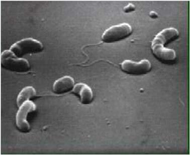 Εικόνα2.6, Το μικρόβιο της χολέρας Το πράσινο «ευρωπαϊκό» καβούρι (Carcinus maenas) Το πράσινο ευρωπαϊκό καβούρι Carcinus maenas(εικόνα2.