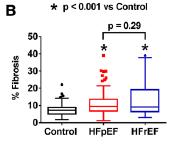 αραίωσης και ίνωσης μεταξύ HFpEF και HFrEF Διήθηση μυοκαρδίου από TG: - Μείωση circumferential SR, διαστολική
