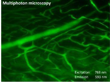 άμεσα in-vivo (μόνο σε ανατομικό παρασκεύασμα μετά έγχυση σκιαγραφικού) Herrmann J, et al.