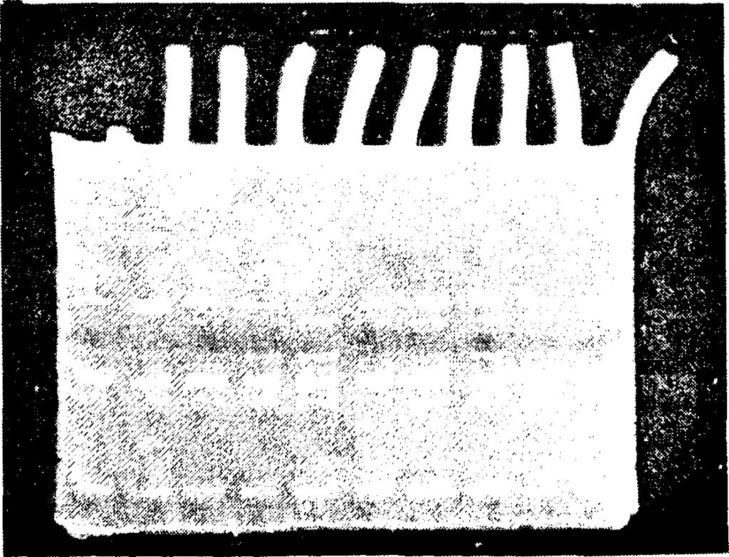 66 αριστερός εκκινητής (5 ACAGAATTCGCCCCGGCCTGGTACACTGCCA3 )]. Μετά από μια φάση αποδιάταξη της διπλής έλικας του DNA στους 95 C για 5 λεπτά, η PCR έγινε σε 35 κύκλους.