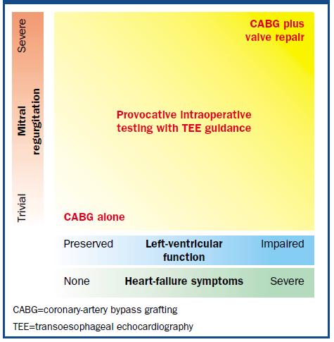 Provocative intraoperative testing with TEE guidance preload and afterload challenges Ø No MV repair: both tests are negative regurgitation is induced but