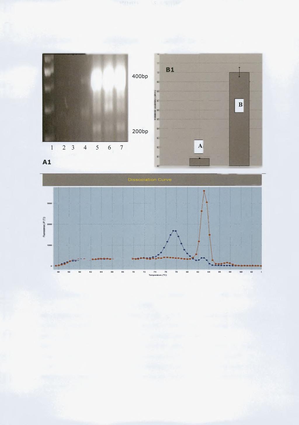 5.2 ΕΛΕΓΧΟΣ ΤΗΣ ΑΠΟΣΙΩΠΗΣΗΣ ΤΗΣ CNOT7 ME REAL-TIME PCR Εικ.