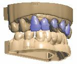 στοιχείου: 80247010 + 80247011) Περιλαμβάνεται ΔΩΡΕΑΝ Εργαστηριακές σαρώσεις Dental Wings Δεν απαιτείται πρόσθετο εάν οι σαρώσεις είναι διαχωρισμένες Model Builder STL
