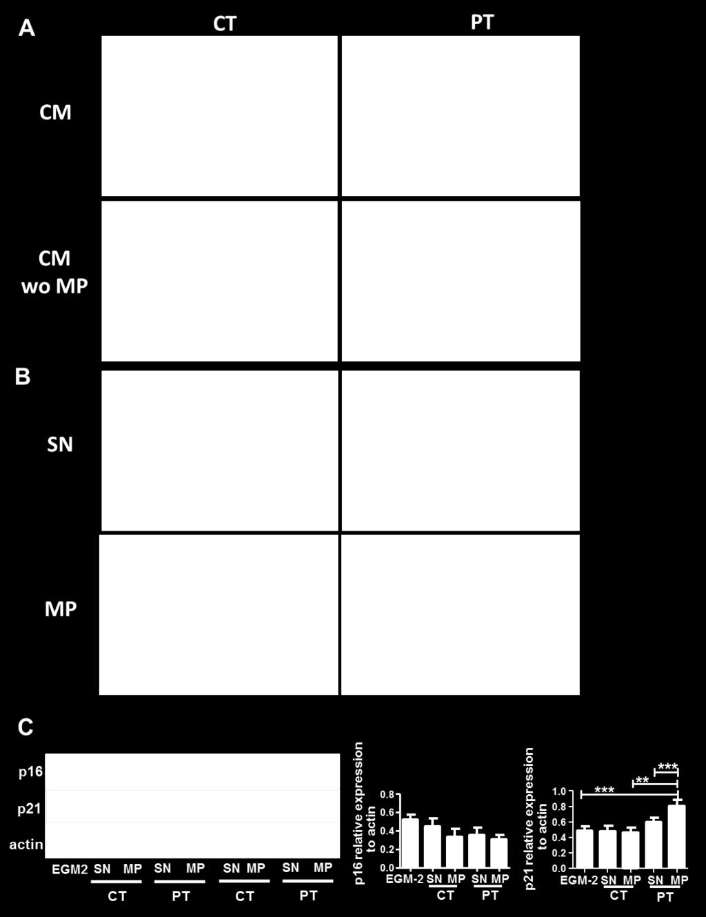 from CT- and PT-ECFC (B). After 48h, SA-β-gal staining was performed for evaluation of the senescence status.