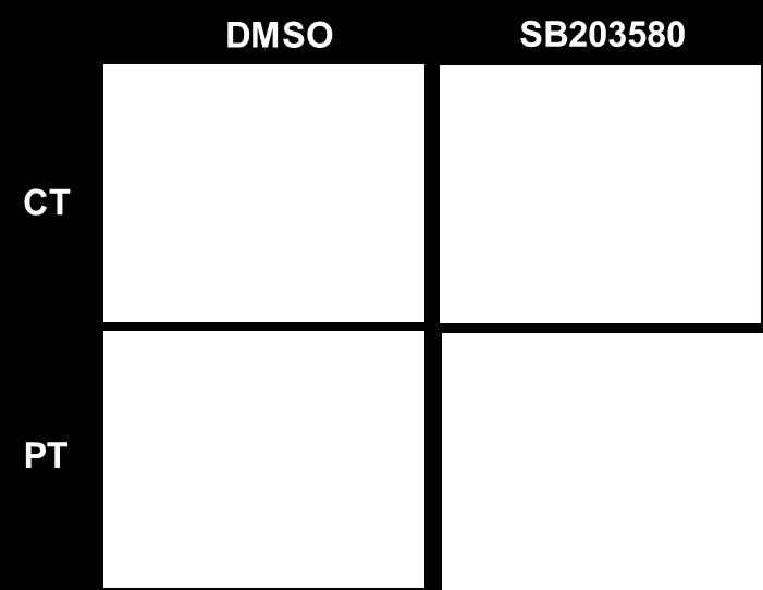 presence or not of 2µM SB203580 for 48h.