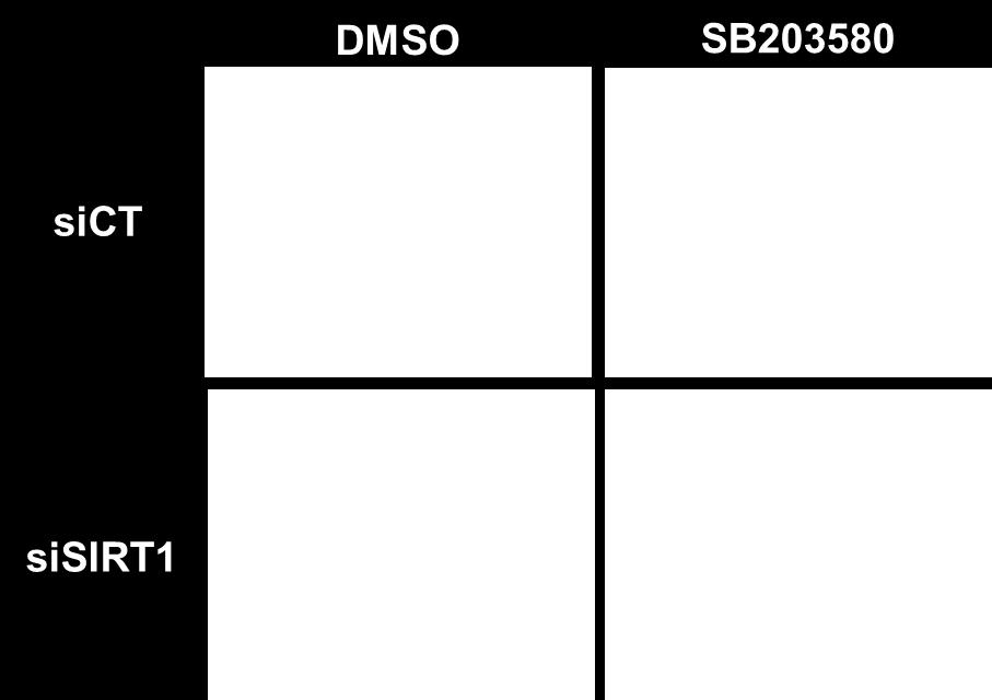 not of 2µM SB203580 for an additional 24h.