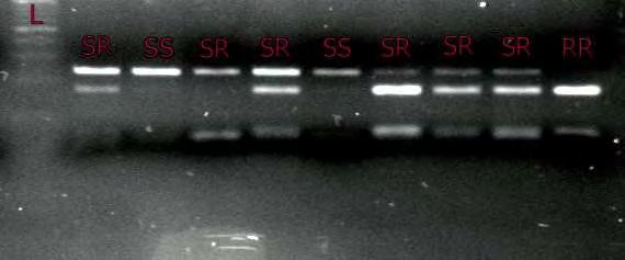 200bp 100bp Εικόνα 16. Αποτελέσματα ηλεκτροφόρησης πέψεων των προϊόντων ενίσχυσης του τρίτου εξονίου του γονιδίου της ακετυλοχολινεστεράσης του B. οleae με το ένζυμο AccI.