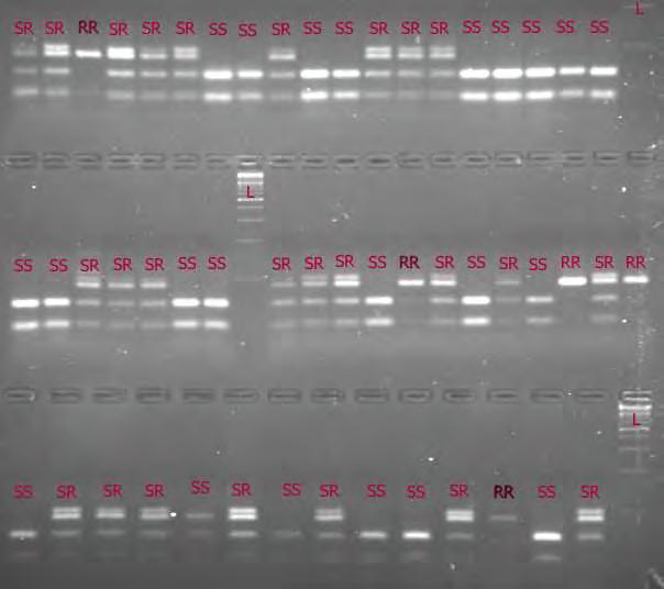 αναγνώρισης του ένζυμου περιορισμού MwoI. Βάσει αυτού του γεγονότος μπορεί να ανιχνευθεί η μετάλλαξη με την εφαρμογή μιας PCR-RFLP δοκιμασίας.