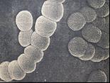 Lactococcus lactis subsp. lactis 1/2 Σε μορφή ελλειπτικών ή σφαιρικών κόκκων (0,5 1,0 μm) σε μικρές αλυσίδες ή ζεύγη.