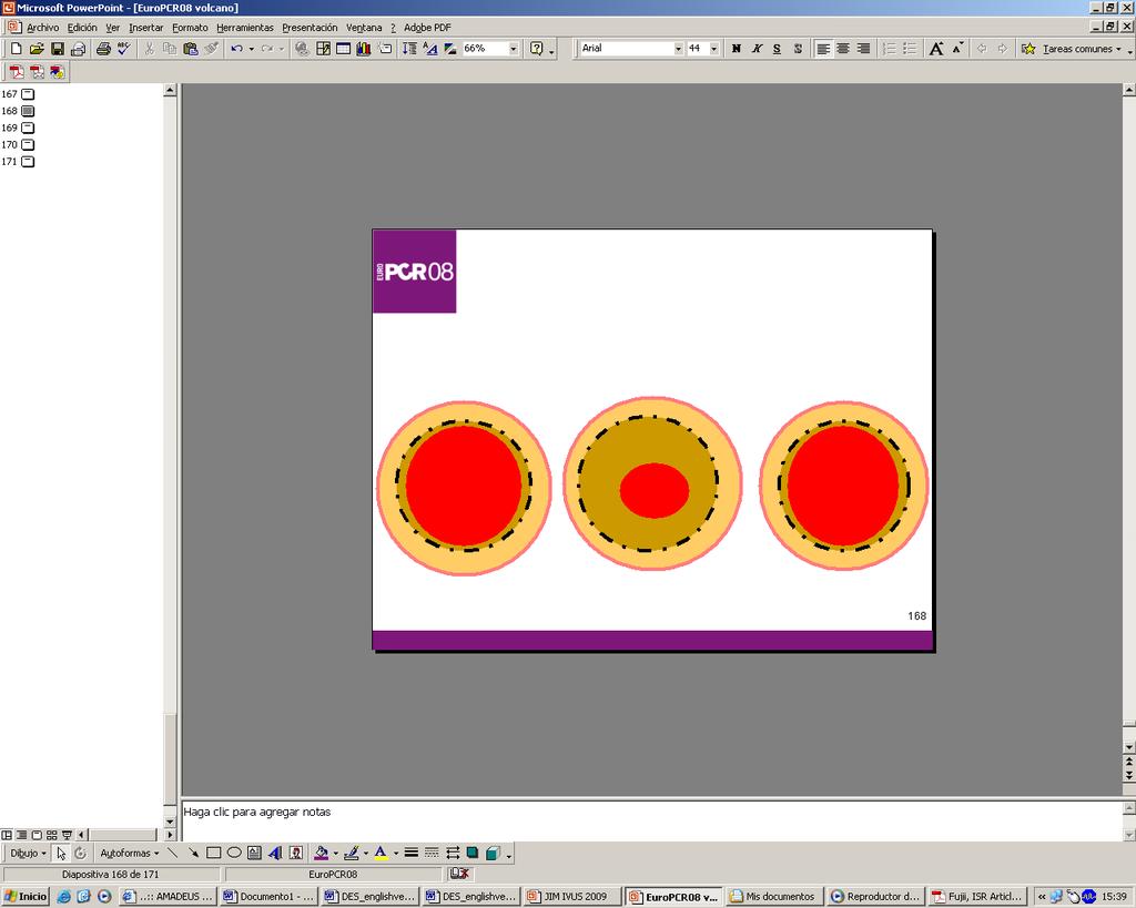 IVUS insights for BMS/DES restenosis: Therapeutic