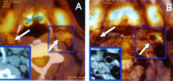 PET- MRI